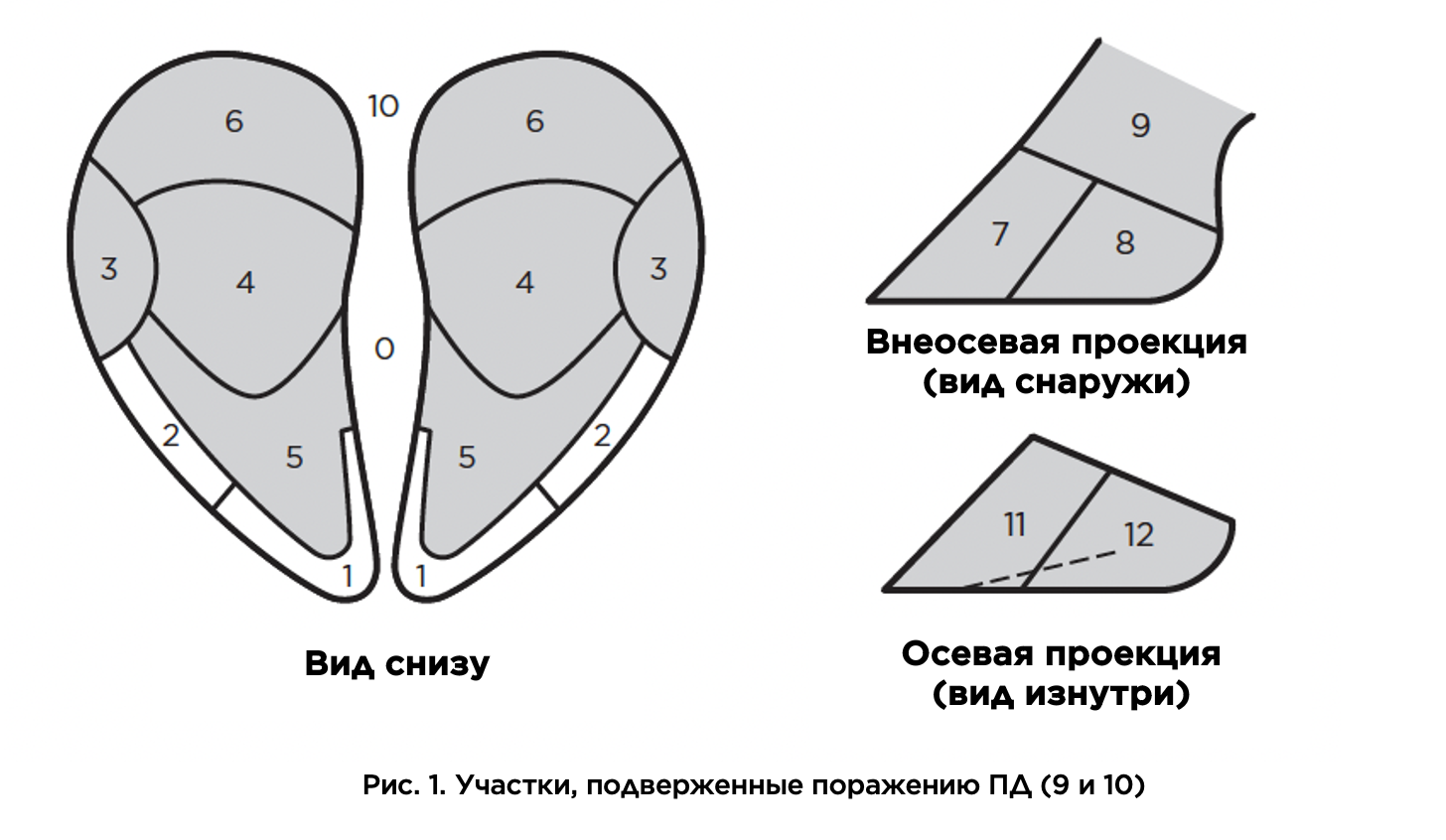 Участки поражения копыт при пальцевом дерматите